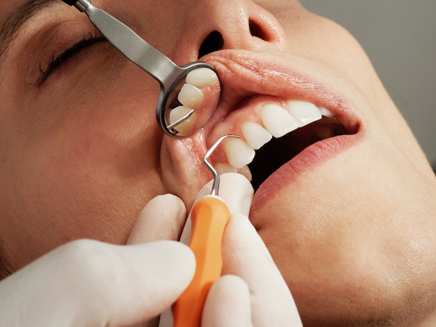 5 Common Myths About Dental Health You Should Know - Cleaning