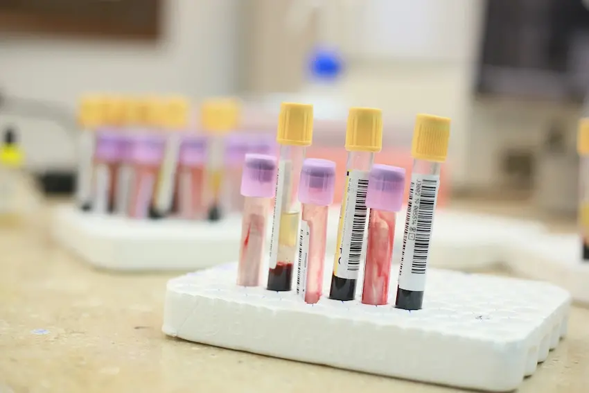 Health Fix - The Importance Of Monitoring Your Blood - Blood Samples